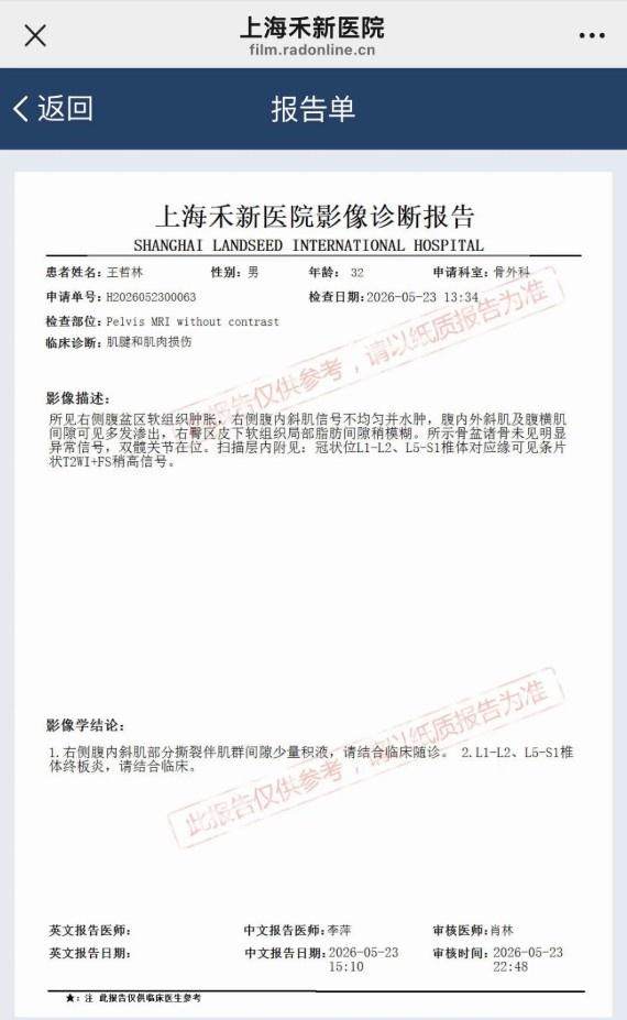 吐槽：1.78亿 ,篮网要签里弗斯？文班少林功夫白练了！